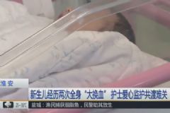 新生兒患上溶血癥，經(jīng)歷了兩次全身“大換血”，溶血癥的癥狀[多圖]
