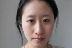 為什么敷完面膜臉上搓泥？敷完面膜臉上搓泥怎么辦？[圖]