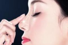 玻尿酸隆鼻能保持多久？玻尿酸隆鼻多久消腫？[多圖]