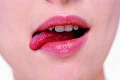 舌頭下面長(zhǎng)了個(gè)小肉什么原因？舌下有小肉芽怎么回事？[圖]