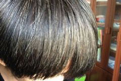 16歲為什么有白頭發(fā)？16歲長(zhǎng)白頭發(fā)是什么原因？[多圖]