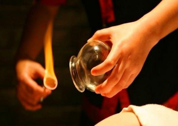 拔火罐真的能去濕氣嗎 舒通經絡祛除瘀滯行氣活血