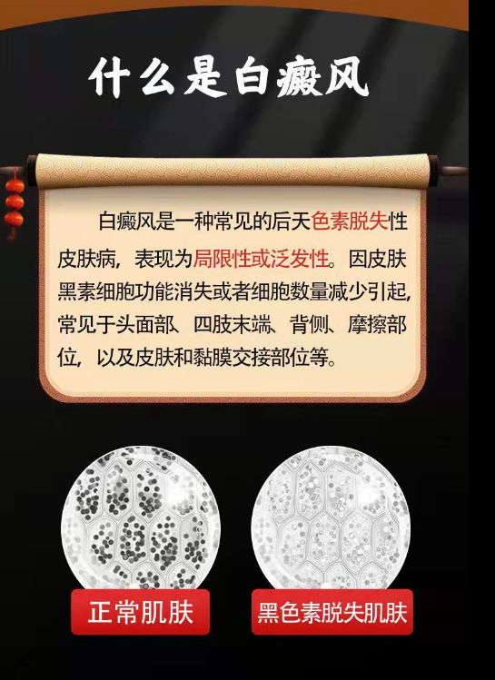 佰草中醫補骨脂白斑抑菌液