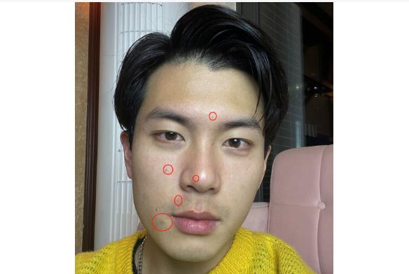 為什么男生皮膚會出油？男生皮膚出油怎么辦？