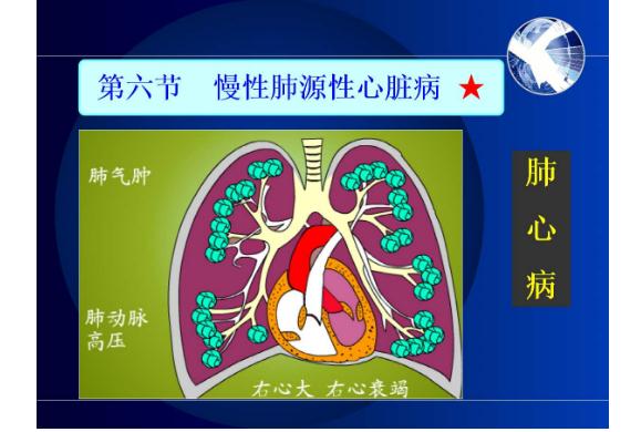冠心病是心臟病嗎？什么是肺源性心臟病？
