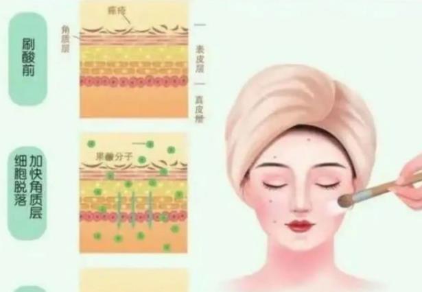 哪些人不適合刷酸 皮膚狀態不穩定孕婦及哺乳期女性