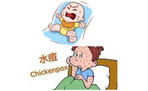 為什么會得水痘呢？出水痘應該注意什么？