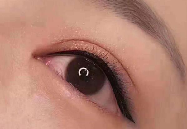 紋美瞳線(xiàn)后多久消腫 美瞳線(xiàn)眼腫怎么消腫