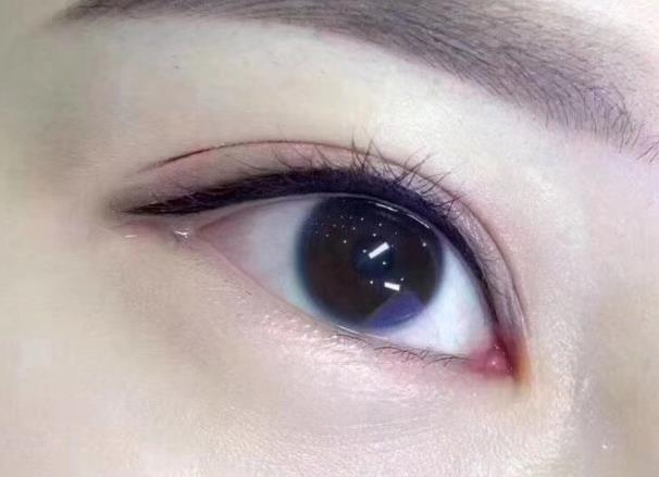 美瞳線(xiàn)暈色怎么辦 美瞳線(xiàn)后期暈色怎么回事