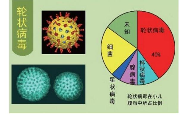 輪狀病毒發病有哪些特點？感染輪狀病毒后可以吃什么？