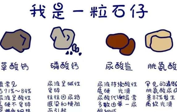 腎結石用激光打好嗎 腎結石用激光打要多久